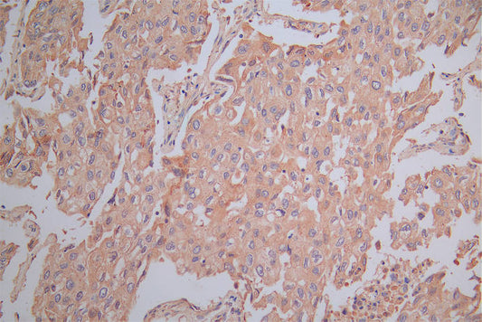SLAMF7 Recombinant Monoclonal Antibody