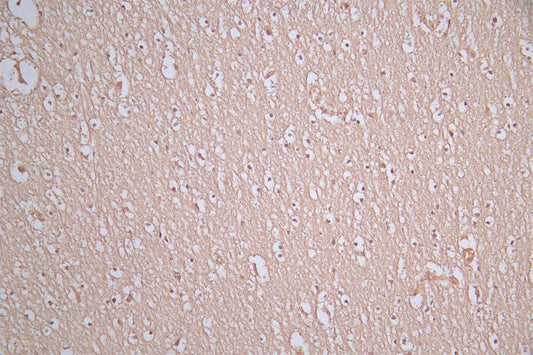 SNCA Recombinant Monoclonal Antibody