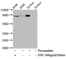 Phospho-STAT3 (Tyr705) Antibody