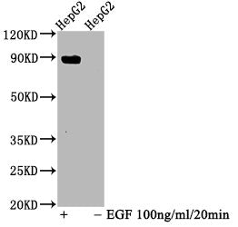 Phospho-STAT5A (Y694) Antibody