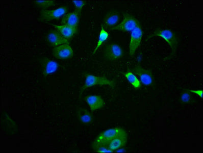Phospho-TP53 (S9) Antibody