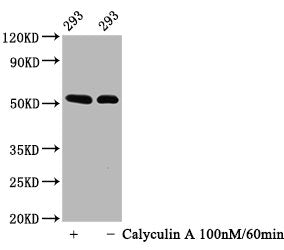 Phospho-TP53 (S392) Antibody