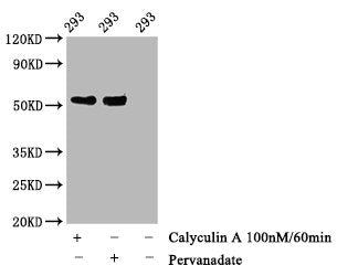 Phospho-TP53 (T55) Antibody