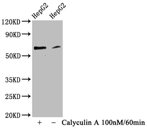 Phospho-YAP1 (S127) Antibody