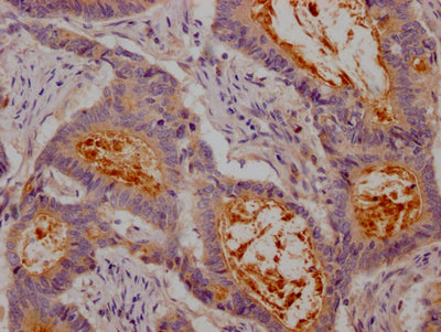 CEACAM1 Antibody