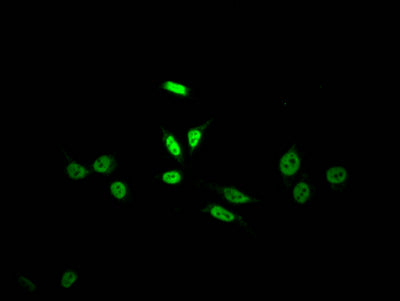 SKP2 Antibody