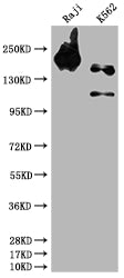 INPP5D Antibody
