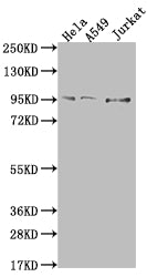 CARS Antibody