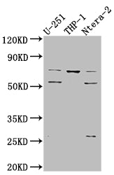 PTH1R Antibody