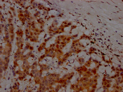 ATM Antibody