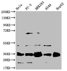 HMGCL Antibody