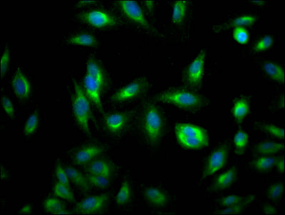 RHEB Antibody