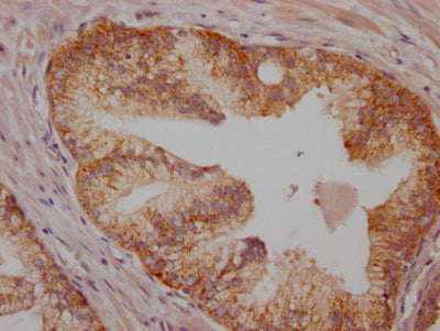 BRAF Antibody