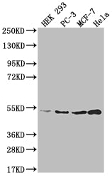 AHCY Antibody