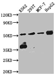 CHEK1 Antibody