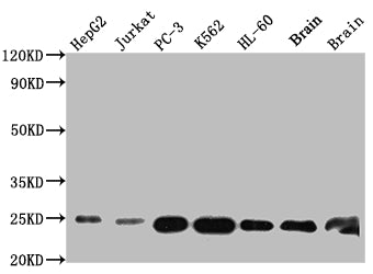 GSTP1 Antibody