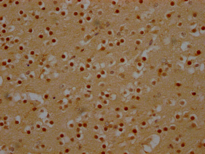 DDX6 Antibody