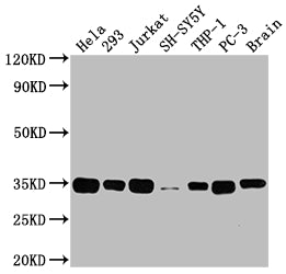 ATF5 Antibody