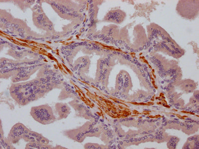 TRPM8 Antibody