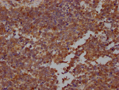 STAT3 Antibody