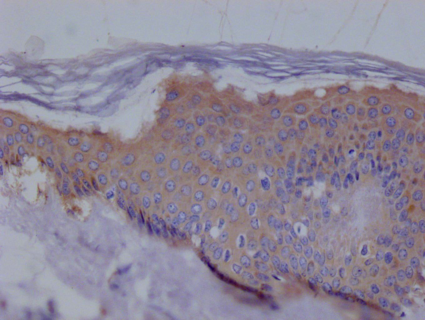 EZR Antibody