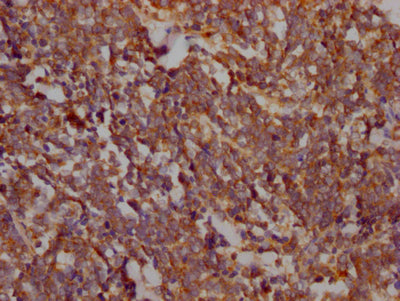 PTK2 Antibody