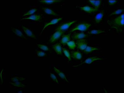 CCNE1 Antibody