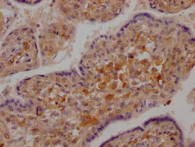 DDX58 Antibody