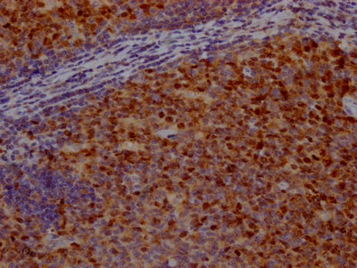 BIRC5 Antibody