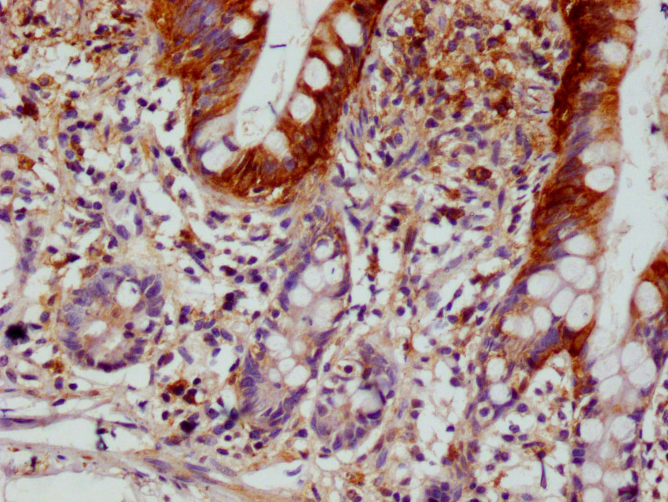 SCIN Antibody