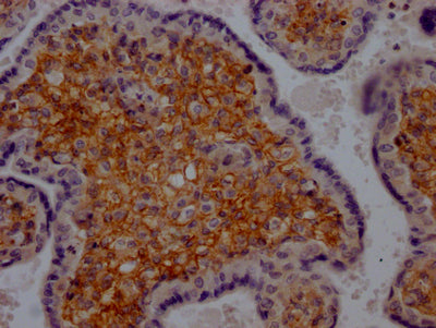 PDGFRB Antibody