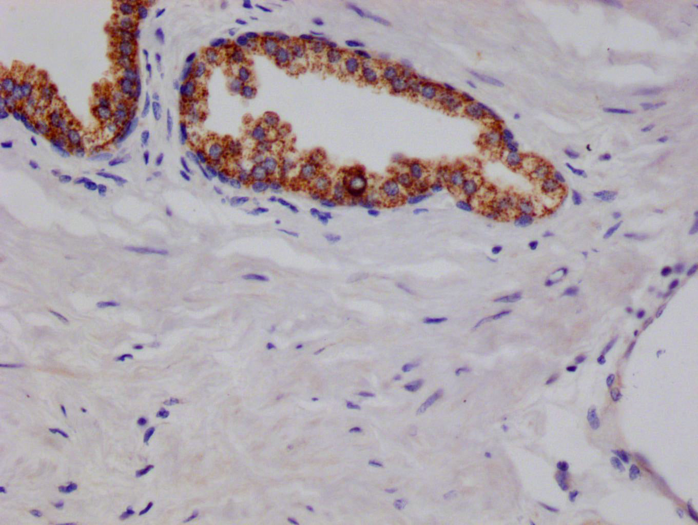 ARG2 Antibody
