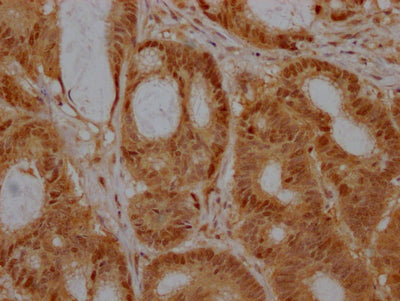 EZH2 Antibody