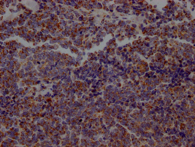 ACO2 Antibody