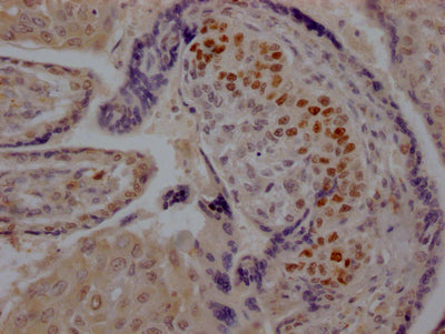 SKP2 Antibody
