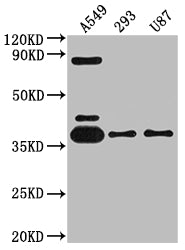 ADORA1 Antibody