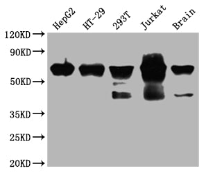 DDX5 Antibody