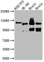 OGT Antibody