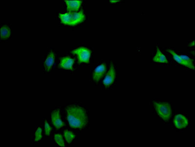 FASN Antibody