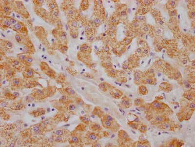ABAT Antibody