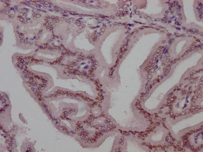 AR Antibody