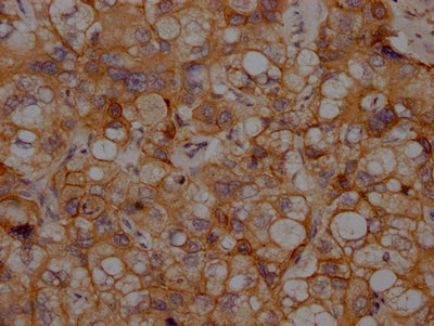 CDH2 Antibody