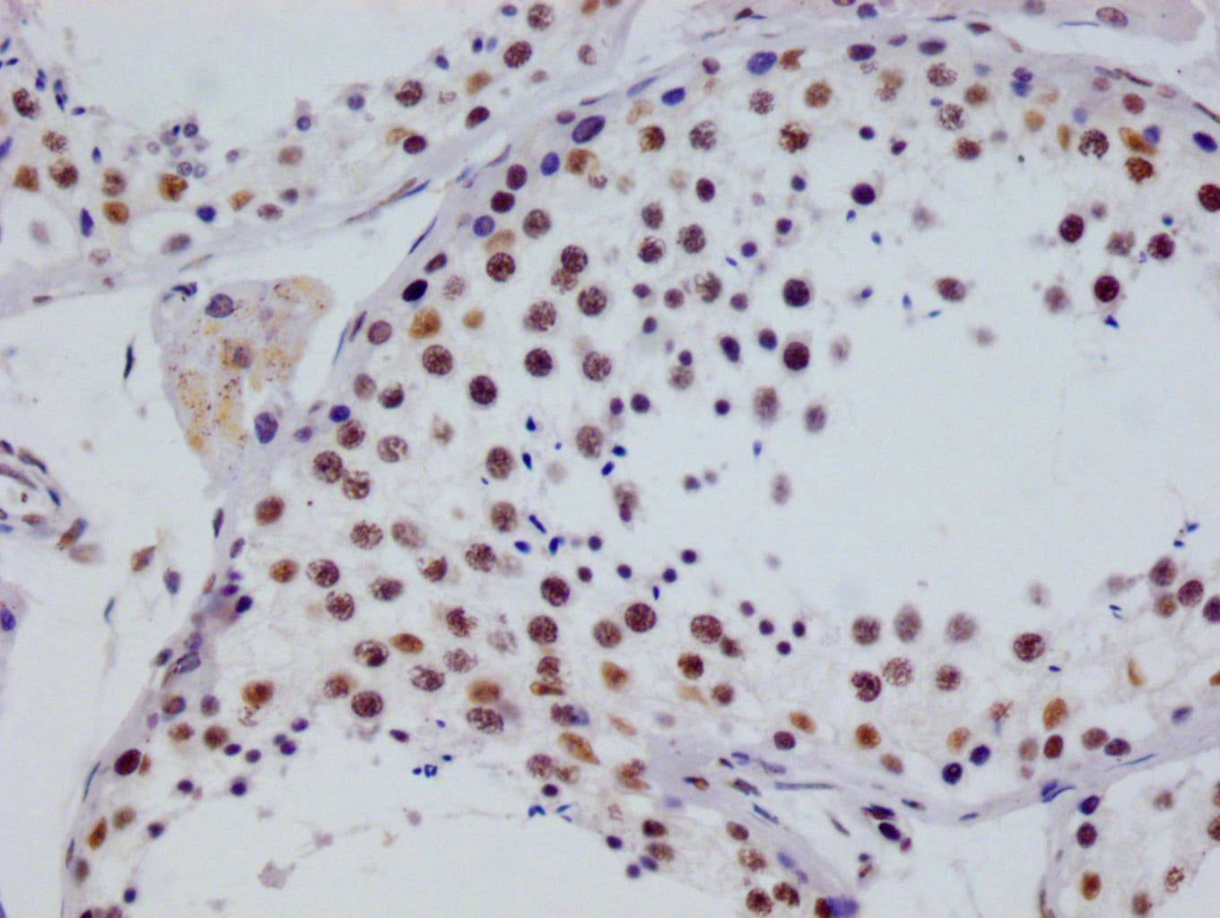 RGS6 Antibody