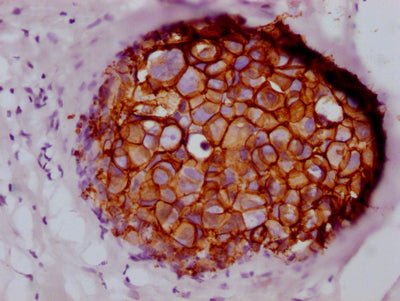 ERBB2 Antibody