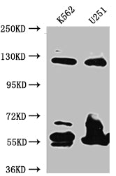 BUB1B Antibody