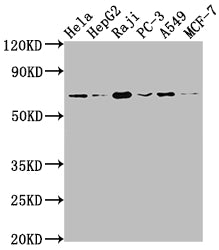 ALAS1 Antibody