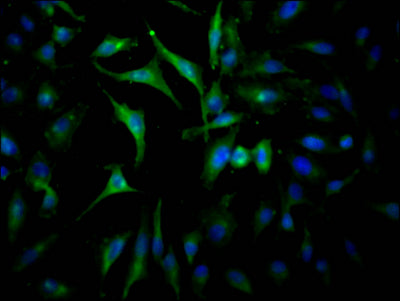 JAK2 Antibody