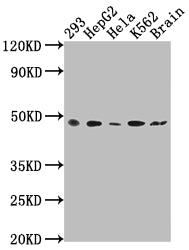 FNTB Antibody