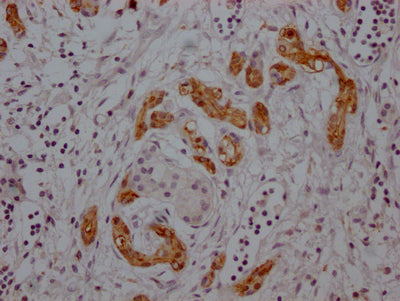 MDK Antibody