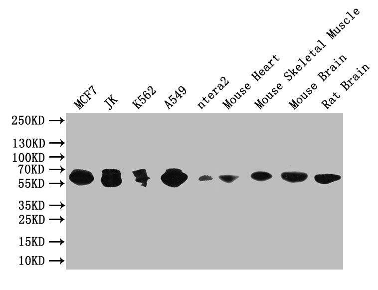 PAK1 Antibody